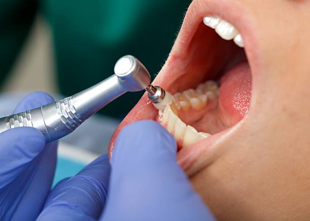 Oral Cancer Screening in Mitchell, IL